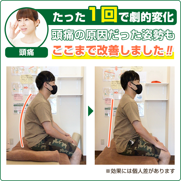 ビフォーアフター